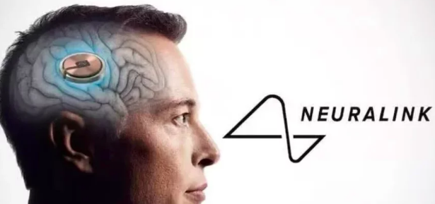 Neuralink, de Elon Musk, implanta chip em cérebro humano